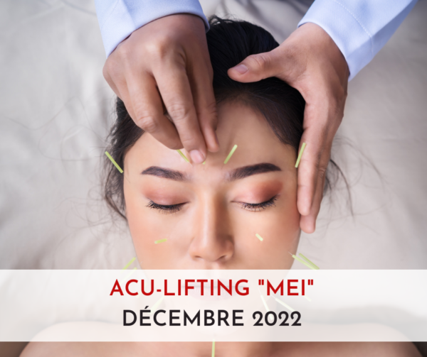 formation aculifting toulouse
