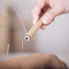 Moxibustion Toulouse