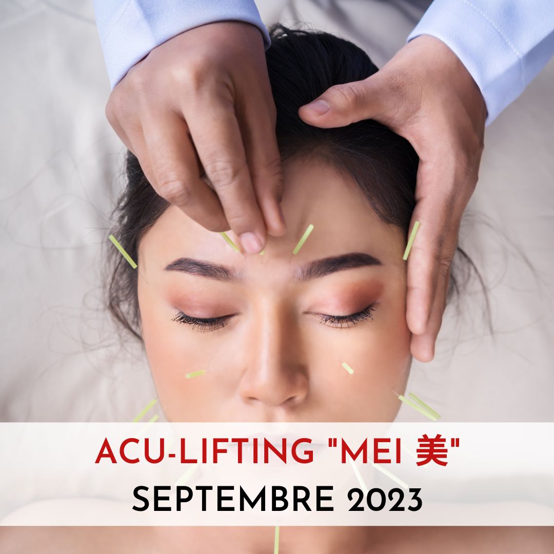 formation aculifting