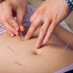 acupuncture nguyen formation pratique w2