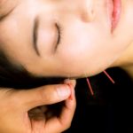 formation acu-lifting du visage yulong